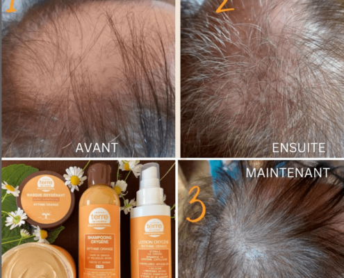 antichute de cheveux alopécie coiffeurs