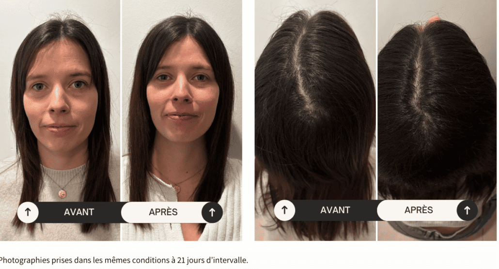 Témoignages de Mélanie laurent Témoignages de Mélanie, cliente qui a fait la cure Choc